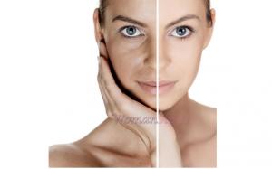 BẠN ĐÃ BIẾT: Cách trị nám không xâm lấn hiệu quả trong thời gian ngắn?