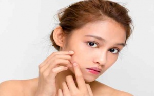 5 thói quen xấu đang là 'thủ phạm' gây mụn trứng cá