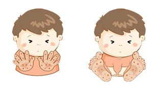 Inforgraphics: Khi nào điều trị tay chân miệng tại nhà?