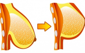 7 tư thế yoga giúp ngực đẹp và săn chắc