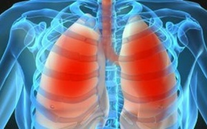 Phát hiện ca lao siêu kháng thuốc ở Đồng Nai