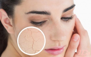 6 vấn đề ở da cảnh báo bệnh nguy hiểm