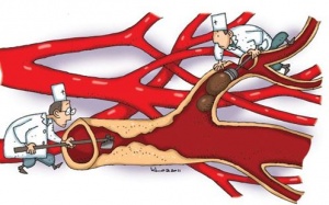 'Công thức vàng' làm sạch mạch máu, giảm mỡ máu: Bài thuốc nên có trong mọi gia đình