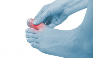 Chuột rút ngón chân: Đối phó như thế nào?