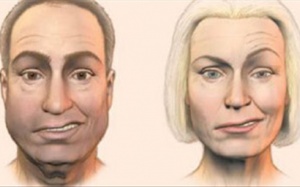 Liệt mặt, méo miệng do nhiễm lạnh