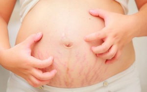 Bà bầu bị nổi mề đay khi mang thai có nguy hiểm?