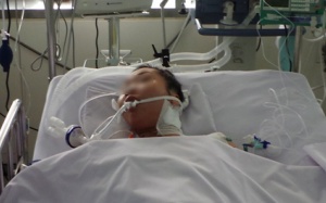 Cô giáo trẻ nguy kịch vì ong 'lạc' vào mũ bảo hiểm