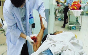 Gãy tay gãy chân chỉ vì... áo khoác không cài dây khóa