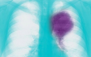 Những hình ảnh đầy màu sắc tiết lộ cơn đau như thế nào từ sâu trong cơ thể