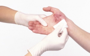 3 cách tự chữa bệnh cần quên ngay lập tức