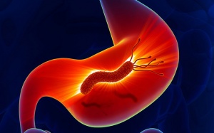 6 dấu hiệu cảnh báo ung thư dạ dày đã cận kề: Bức ảnh dưới đây giúp bạn nhận biết bệnh