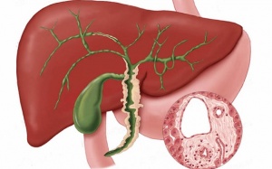 Các biện pháp tự nhiên hỗ trợ điều trị bệnh xơ gan ứ mật