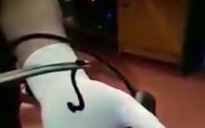 Kinh hãi gắp con vắt trong họng bé gái 12 tuổi