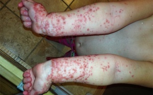 Lý do bố mẹ nhất định phải tắm rửa cho con sau khi đi chơi công viên, không phải ai cũng may mắn