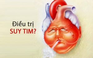 Bạn đã biết cách tốt nhất để điều trị suy tim?
