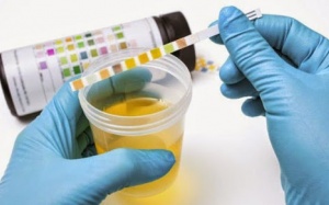 [Inforgraphics]: Tiết lộ sức khỏe qua 11 màu nước tiểu