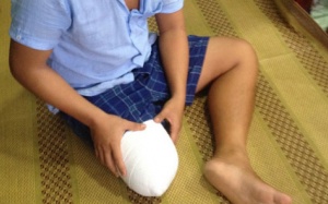 Vụ bệnh nhân bị cưa chân: Gia đình đề nghị khởi tố bác sỹ