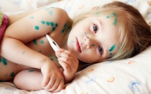 Những quan niệm sai lầm khi chữa thủy đậu cho con