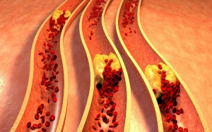 Cách giảm cholesterol đơn giản từ bột yến mạch và hạnh nhân
