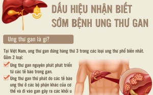 [Inforgraphics]: Dấu hiệu nhận biết sớm ung thư gan
