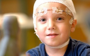 Tìm hiểu về hội chứng động kinh nghiêm trọng nhất ở trẻ	