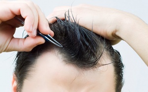 Bỏ ngay thói quen nhổ tóc, nặn mụn đầu đen, dụi mắt... vì lý do này