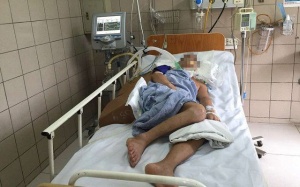 Cảnh báo: Rắn độc cắn người lại vào mùa!