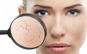 5 triệu chứng thiếu hụt vitamin trên khuôn mặt bạn cần quan tâm