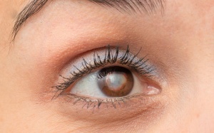 Những phương pháp đơn giản giảm đục thủy tinh thể