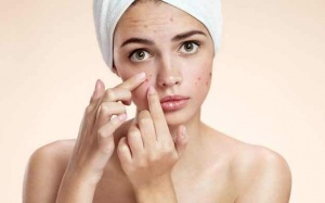 Chăm sóc da thế nào khi bị mụn trứng cá?