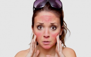 Hạ nhiệt làn da cháy nắng bằng cách tự nhiên