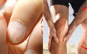 7 dấu hiệu cảnh báo cơ thể đang có vấn đề và cách xử trí