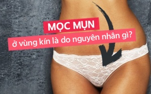 Mọc mụn ở âm đạo là bệnh gì?