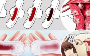Màu sắc kinh nguyệt tiết lộ điều gì về sức khỏe của bạn?
