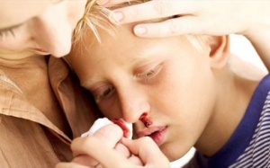 Tìm hiểu về bệnh lý xuất huyết giảm tiểu cầu vô căn ở trẻ em