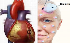 4 tác hại nghiêm trọng của đường đối với cơ thể