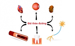 Làm sao phòng ngừa các biến chứng đái tháo đường nguy hiểm?