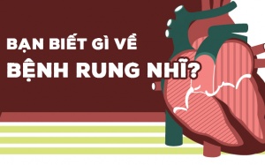 Bạn biết gì về bệnh rối loạn nhịp tim nhanh rung nhĩ?