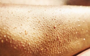 Tại sao chúng ta nổi da gà?