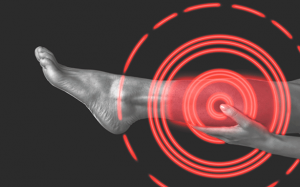 Nhận diện cục máu đông nguy hiểm trong cơ thể