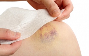 Nguyên nhân do đâu dẫn đến xuất huyết giảm tiểu cầu?