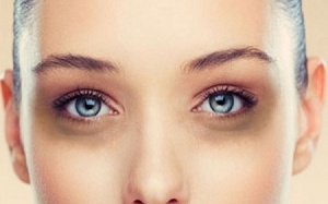 5 biện pháp tự nhiên giúp bạn tạm biệt quầng thâm và bọng mắt