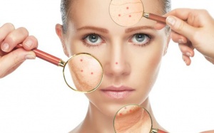 Video: Những sự thật về mụn ở người trưởng thành!