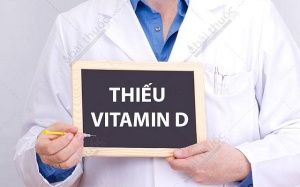 Thiếu vitamin D do sử dụng thuốc chống động kinh phải làm sao?