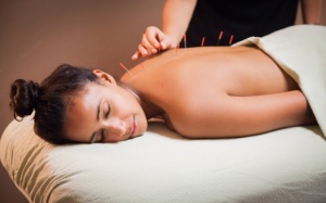 Châm cứu tốt cho sức khỏe như thế nào?