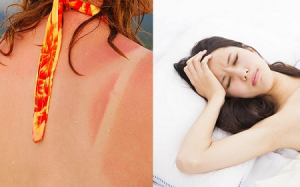 5 dấu hiệu cho thấy bạn đang bị 'ngộ độc nắng'