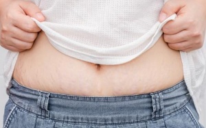 Trị rạn da: Hãy áp dụng nhanh 4 mẹo với nha đam!