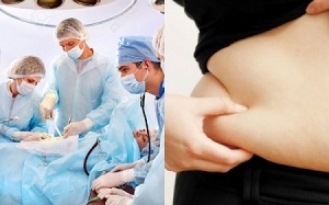 Vì sao dễ bị tăng cân sau phẫu thuật?