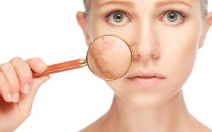 Mỹ phẩm tự nhiên cho da nhờn, mụn nhọt, nếp nhăn 