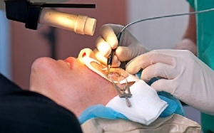 Phẫu thuật mắt bằng laser có những rủi ro gì?